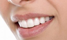 Khắc phục răng ố vàng
