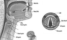 Mềm sụn thanh quản có nguy hiểm?