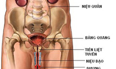 Dùng thuốc trị nhiễm khuẩn tiết niệu 