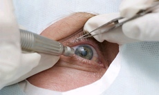 Lão hóa mắt ở người cao tuổi có đáng lo?