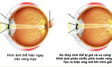 Lão thị: Sử dụng kính thế nào cho đúng?