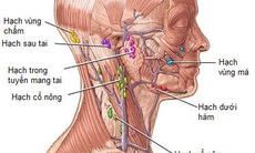 Hạch sưng, đau có phải trọng bệnh?