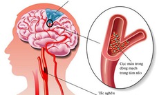 Thuốc tuần hoàn não và lưu ý khi sử dụng