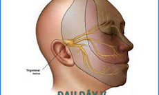 Có phải bị đau dây thần kinh số 5?