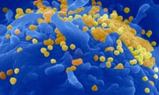 Các nhà khoa học khám phá bí ẩn lớn nhất của HIV 
