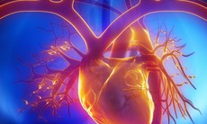 Có thể in sinh học trái tim 3D đầu tiên trong vòng 10 năm tới