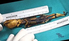 Bộ xương giống người ngoài hành tinh tiết lộ nhiều bí ẩn y học