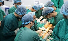 U men răng kích thước "khủng"