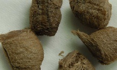 Tổ bọ ngựa - Chữa tiểu tiện không thông