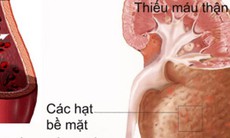 Các kháng sinh gây hại cho thận