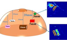 Da điện tử - Cuộc cách mạng trong phát hiện sớm ung thư vú