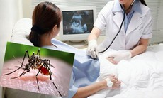 Dự phòng và giảm thiểu nguy cơ trẻ mắc chứng đầu nhỏ do virut Zika