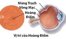 Cảnh báo: Thoái hóa điểm vàng đang trẻ hóa