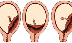 Những điều ít biết về nhau thai