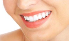 Hạn chế khó chịu sau làm trắng răng