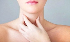 Bướu nhân tuyến giáp chữa thế nào?