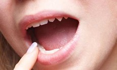 Sùi mào gà ở lưỡi biểu hiện thế nào?