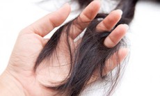 Cách hạn chế chứng nhiều gàu