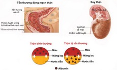 Phòng ngừa tăng huyết áp ở tuổi mãn kinh