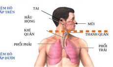 Phòng bệnh nhiễm khuẩn đường hô hấp khi giao mùa