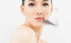 Trị vết thâm trên da như thế nào?