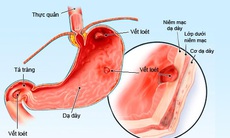 Thuốc chống co thắt gây bất lợi gì?