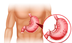 Điều trị viêm hang vị sung huyết