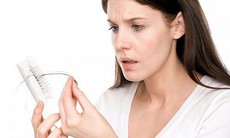 Chứng rụng tóc nhiều, do đâu?
