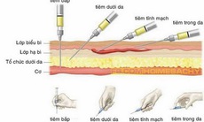 Xử trí phản ứng bất lợi thường gặp khi dùng thuốc tiêm