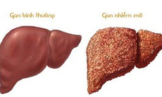 Dược thiện cho người bệnh gan nhiễm mỡ