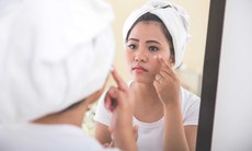 Nhận biết dị ứng mỹ phẩm