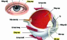 Viêm củng mạc: Nguyên nhân, dấu hiệu nhận biết và các phương pháp điều trị