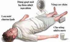 Sơ cứu say nắng, say nóng