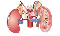 Viêm cầu thận mạn tính có đáng lo?