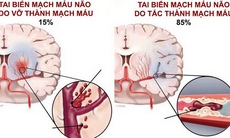 Tai biến mạch máu não: Cấp cứu thế nào để tránh tử vong?