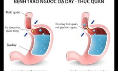 Dấu hiệu nhận biết bệnh trào ngược dạ dày - thực quản