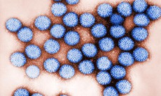 Xử trí trường hợp tiêu chảy do Rotavirus