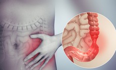 Dấu hiệu viêm đại tràng co thắt