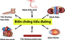 Đề phòng biến chứng xương khớp ở bệnh nhân đái tháo đường