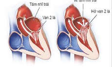 Bài thuốc phòng trị thấp tim