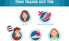 5 dấu hiệu cảnh báo suy tim