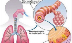 Mật ong - thuốc tốt trị viêm phế quản