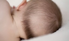 Rụng tóc ở trẻ nhỏ có phải do còi xương?
