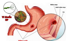 Teo niêm mạc dạ dày có nguy hiểm?