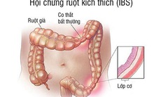 Tác dụng phụ của thuốc trị hội chứng ruột kích thích