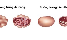 Tác hại do dậy thì sớm ở bé gái