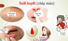 Phát hiện, xử trí sớm sốt xuất huyết