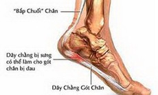 Dùng thuốc khi bị đau gót chân