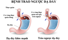 Thuốc hay chữa bệnh từ cây quít