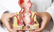 Dấu hiệu nhận biết bệnh trĩ